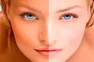 Curso Gratuito Online Bronzeamento Natural