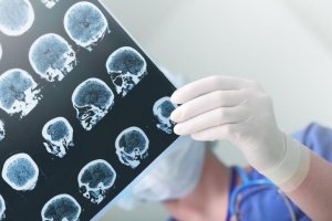 Curso Gratuito Online Neuropsicanálise